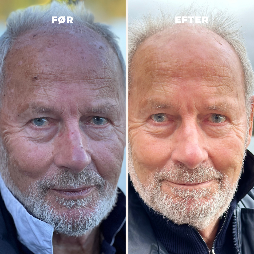 Jan og Grethes oplevelse med NatureCell CBD hudpleje
