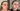 Før og efter emmas oplevelse med CBD Hudpleje