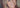 Louises personlige oplevelse med CBD Hudpleje