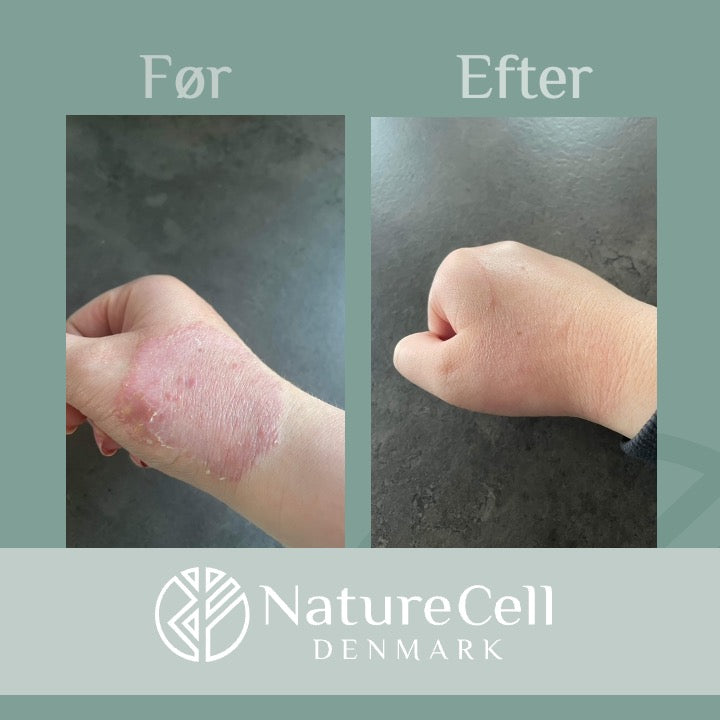 Lunas oplevelse med CBD hudpleje – kundecase med håndcreme og olie